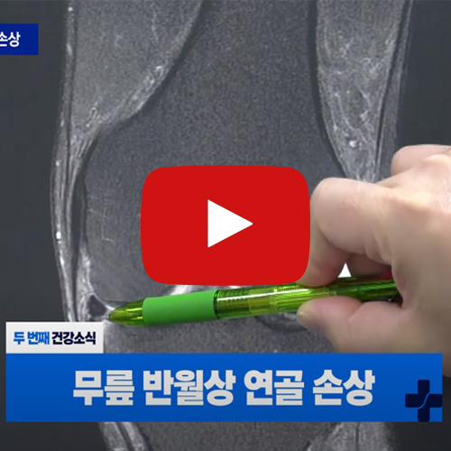 TJB 메디컬 플러스-무릎 반월상 연골 손상